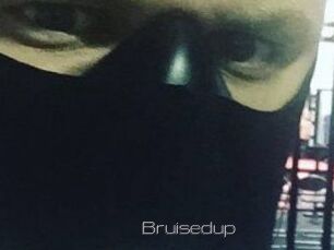 Bruisedup